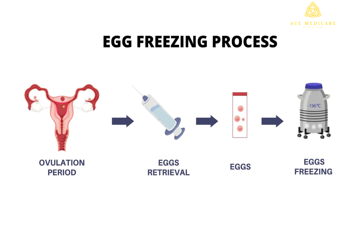 The Cost of Egg Freezing: Budgeting and Financial Planning Tips